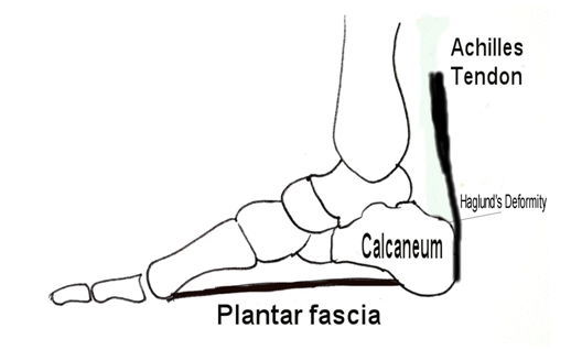 The Achilles tendon