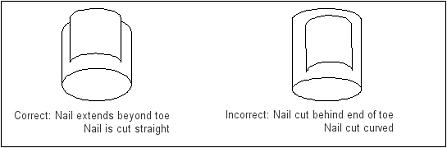 How to cut toenails